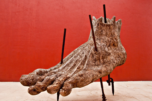 Athlete's Foot